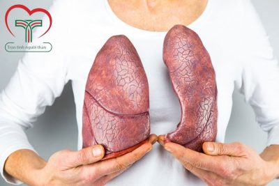 Top 10 nghề nghiệp có nguy cơ mắc bệnh ung thư phổi cao nhất