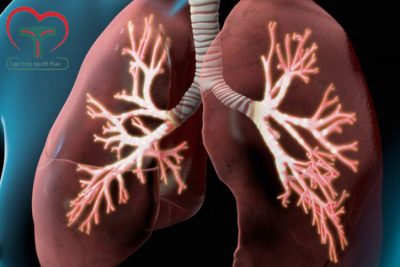 Làm thế nào có thể phát hiện sớm ung thư phổi?